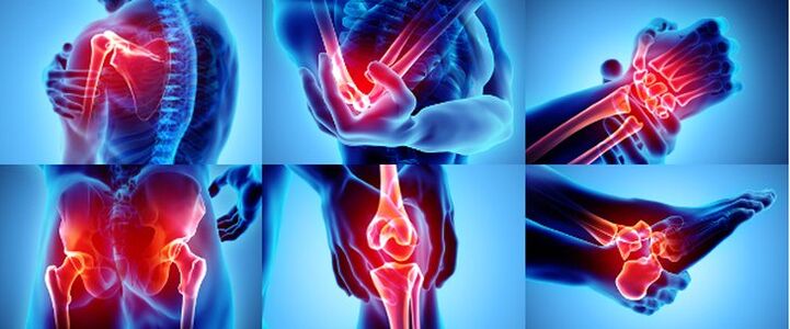 Articulations enflammées